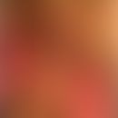 Vulvitis plasmacellularis:&nbsp;umschriebene wenig symptoamitsche rote Plaque. Abb.entnommen aus:...