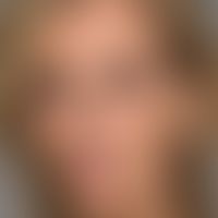 Ozempic-Face: Starke, kosmetisch störende Volumenreduktion nach längerzeitiger GLP-1-Therapie&nbs...