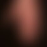 Morbus Addison: deutlich pigmentierte Handlinienmuster bei&nbsp; ansonsten normaler Palmarhaut.&n...
