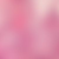 Adnexkarzinom, mikrozystisches. Durchsetzung der gesamten Dermis durch mäßig differenzierte, epit...