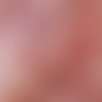 Akanthopapillom. Auflichtmikroskopie (Ausschnitt aus einem Viruspapillom vom Hals): Runde bis pol...