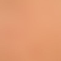 Acne, Majorca acne, detail enlargement: Disseminated standing, 1-3 mm large, reddened, acne-like ...