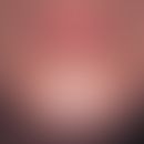 Multiple, flat, reddish papules and spots in the perioral and chin region after chronic use of a ...