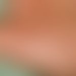Acrokeratoelastoidosis: In a band-shaped arrangement at the transition zone from field skin to gr...