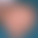 Akropustulose, infantile:&nbsp;disseminierte, teils solitäre, teils gruppiert stehende entzündlic...