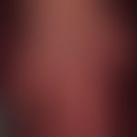 Acrocyanosis in right heart failure in age-related atrophic, shiny skin with solar lentigines on ...