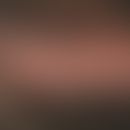 Alopezie, vernarbende. Seit mehreren Jahren persistierende, multiple, glatt atrophische, seitlich...