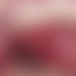 Angina, spezifische. Diffus geschwollene Gaumenmandeln mit grauem Belag. Keine lakunären Eiterpfr...