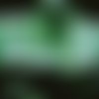 Angiom, seniles. 20 MHz-Sonographie; unscharf begrenzter, protuberierender echoarmer Tumor. Das E...