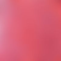 Angiom, seniles. Lobulär gruppierte dünnwandige Gefäße, die mit Erythrozyten prall gefüllt sind.