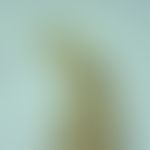 Ankylostomiasis. head of the adult hookworm Necator americanus. there are two crescent-shaped cut...