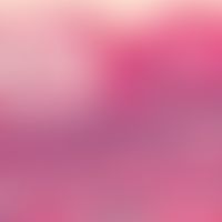 Habituelle Aphthen: Vesikulöses Frühstadium einer Aphthe. Intraepitheliale (spongiotische) Blasen...