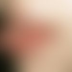 Aphthen&nbsp;habituelle: scharf begrenzte, schmierig belegte, sehr schmerzhafte Ulzera am Zungenr...