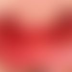 Aphthen, habituelle: seit 10 Tagen bestehende, schmierig belegte, sehr schmerzhafte Ulzera an der...