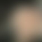 Aplasia cutis congenita. Detailvergrößerung: Klassisch spiegelnde, leicht eingesunkene, hellgelbe...