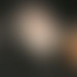 Aplasia cutis congenita. Übersichtsaufnahme: Seit Geburt bestehendes, 1,5 x 1,2 cm großes, haarlo...