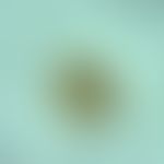 ascaridiasis. ascaris lumbricoides. approx. 50-75 x 40-50 micrometers large, fertile egg. it poss...