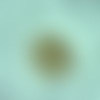 ascaridiasis. ascaris lumbricoides. approx. 50-75 x 40-50 micrometers large, fertile egg. it poss...