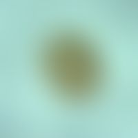 Askaridiasis. Ascaris lumbricoides egg. further development of the larva in the egg. L2 larvae ha...