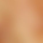 Reflected light microscopy. dyskeratosis follicularis. follicular and perifolicular firmly adheri...