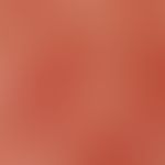 Reflected light microscopy. telangiectasia. dilated capillaries of the horizontal subepidermal va...