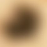 Reflected light microscopy. initial superficially spreading malignant melanoma, Clark Level II, T...