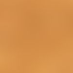 Hair and sebaceous gland follicle ostia with interfollicular double-contour pigment network in da...