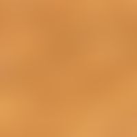 Auflichtmikroskopie. Haar- und Talgdrüsenfollikelostien mit interfollikulärem doppelkonturigem Pi...