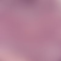 basal cell carcinoma, nodular. detail enlargement from a solid "undifferentiated basal cell carci...