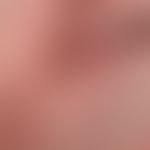 Basal cell carcinoma, nodular. 2.5 years of persistent, slowly growing, now 1.8 x 2.3 cm large, c...