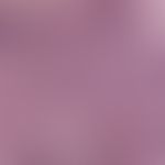Basalzellkarzinom, pigmentiertes:&nbsp;&nbsp;zahlreiche, die gesamte Dermis durchziehende, wenig ...