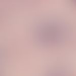 Basalzellkarzinom, sklerodermiformes. Detailvergrößerung: Epitheliale Tumorstränge aus basaloiden...