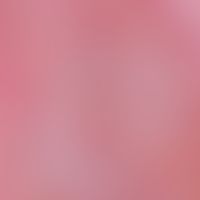 Basal cell carcinoma, solid. reflected light microscopy: In the centre of the figure smaller kera...