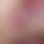 Basal cell carcinoma, solid. chronic, reddish lump with a shiny, smooth surface. clinical and inc...