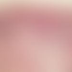 Basal cell carcinoma, superficial, atrophic, orthokeratotic epidermis; in the center bud-like tum...