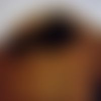 bedbug. bedbug Cimex lectularius ventral view. in the rear part of the bug are the genital openin...