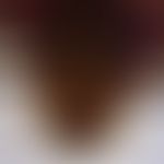 bedbug. bedbug Cimex lectularius: ventral view of the head. from bottom to top: antennae, eyes, i...