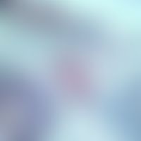 Bilharziose. Schistosoma haematobium in der Harnblase. Querschnitt eines adulten Pärchens (Weibch...