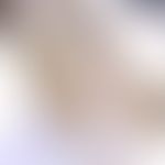 Bilharziose. Ei von Schistosoma mansoni. Deutlich erkennbar ist der typische Seitenstachel. Eigrö...