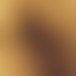 Black heel. reflected light microscopy (groin skin of the heel): Grey-brownish round foci in a st...