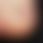 bladder. traumatically induced subepithelial bladder in Epidermolysis bullosa simplex. 7-year-old...
