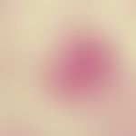 Blastomykose, nordamerikanische. Riesenzelle mit mehreren Blastomyces dermatitidis Zellen; Lunge;...