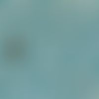 Blastomycosis, South American. multilateral shoot (steering wheel shape) in P. brasiliensis; lung...