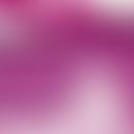 Bowenoide Papulose. Breites, akanthotisches Epithel mit Orthohyperkeratose. Über das gesamte Epit...