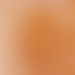 café-au-lait stains. reflected light microscopy: detailed view from a lesion on the thigh in a 36...