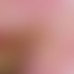 carcinoma, verrucous. detailed view of the chronically stationary skin change. the dry, dirty yel...