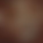 Coccidioidomycose. Sporen und Sphaerulen; Lunge; Fungiqual A u. B Fluoreszenzfärbung(Prof. Dr. H....