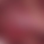 Chronic dynamic (changeable course), painless, superficial ulcer with a whitish margin caused by ...