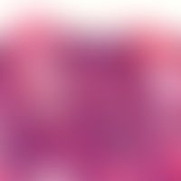 Demodex-Follikulitis (Übersichtsaufnahme): Dilatierte Follikel mit zahlreichen Demodexmilben, die...