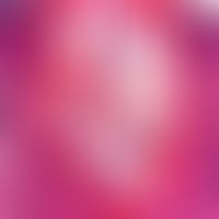 Demodex-Follikulitis (Detailausschnitt: Dilatierter Follikel mit zahlreichen Demodexmilben, die i...